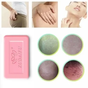 바디워시 Sulfur Anti-mites Anti-acne Body Cleansing Skin Treatment Soap Anti Fungus Soap Beauty Health Kojic Acid Soap Kojic Acid