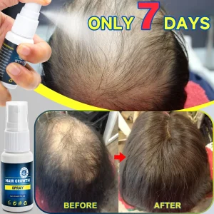 Hair Growth Spray Helps Fast Growth Hair Repair Hair Care Scalp Nourish Hair Roots Men And Women Natural Plant Prevent Hair Loss