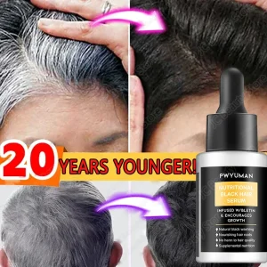 Gray White Hair Treatment Serum White Black Natural Color Hair Growth Oils Fast Regrowth Anti Hair Loss Beauty Health Women Men