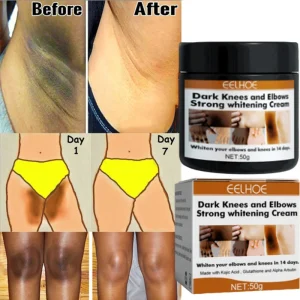 Body Whitening Cream Fast Bleach Private Parts Lighten Underarm Legs Knees Melanin Intimate Areas Remove Dark Spot Beauty Health