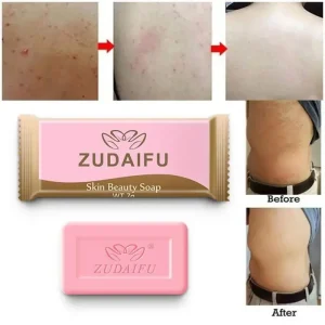 바디워시 Sulfur Anti-mites Anti-acne Body Cleansing Skin Treatment Soap Anti Fungus Soap Beauty Health Kojic Acid Soap Kojic Acid