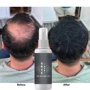 Magic Hair Regrowth Spray Essence Serum Health Grow Liquid Hair Loss Head Care Ginger Oil Products for Men Women