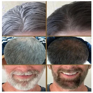 Gray White Hair Treatment Serum White Black Natural Color Hair Growth Oils Fast Regrowth Anti Hair Loss Beauty Health Women Men