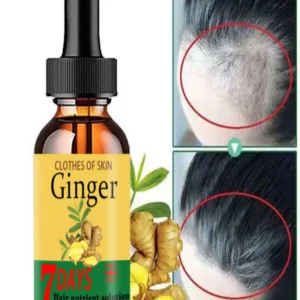 Ginger Hair Growth Essential Oil Fast Hair Growth Serum Spray Prevent Anti Hair Loss Scalp Treatments Beauty Health Hair Care